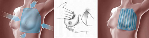 aftoexetasi-maston-8