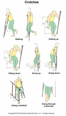 apokatastasi-arthrosis-7
