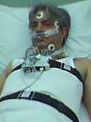 meleti_ypnou-pneumonologist