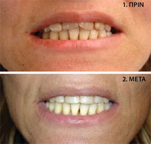 periodontopathia-rigatos1